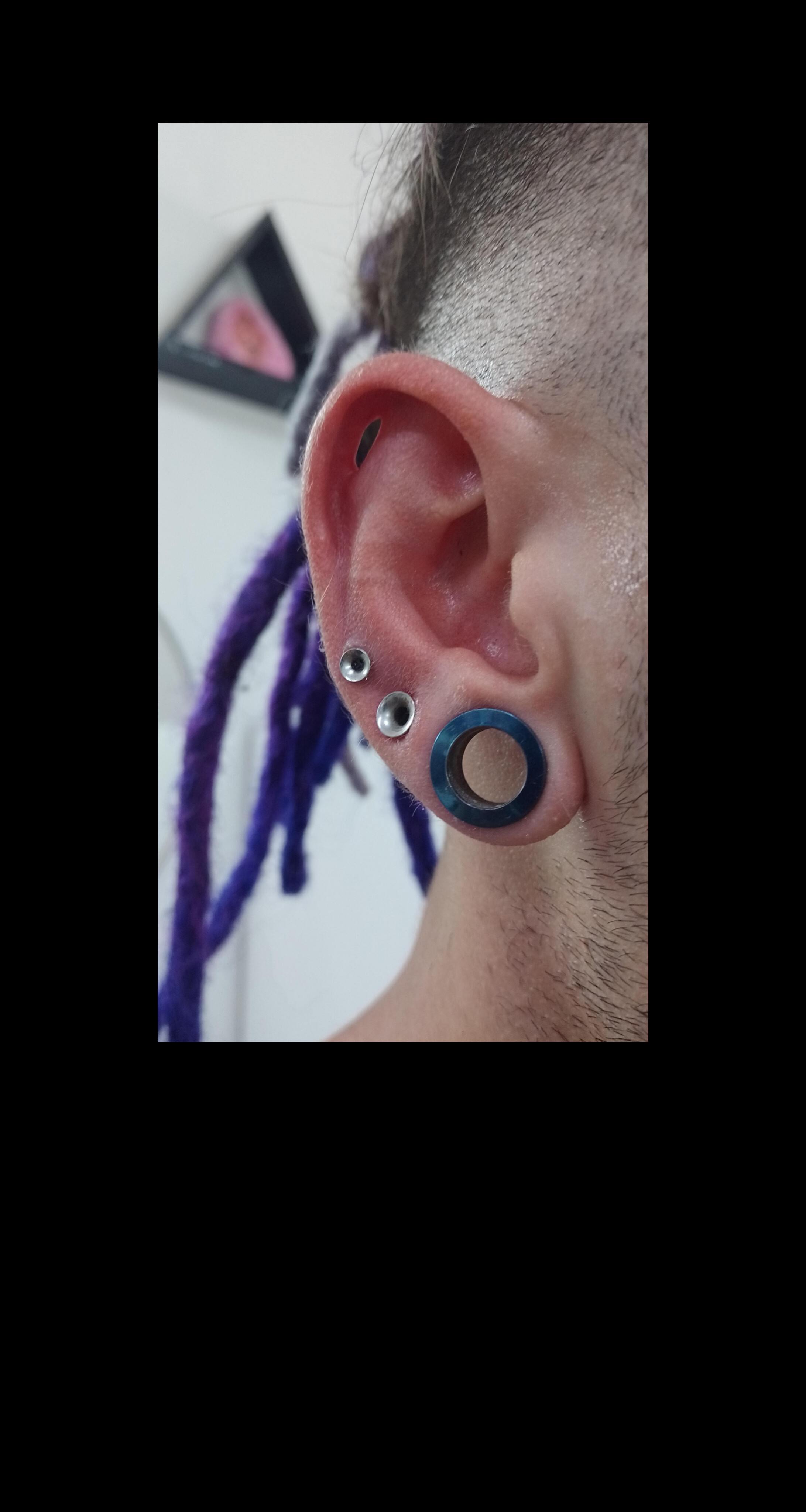 Colocación de expansores
