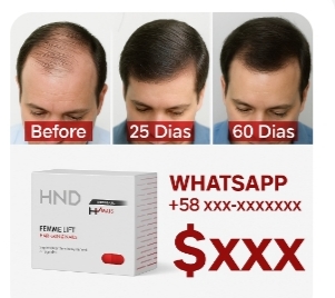 Botox